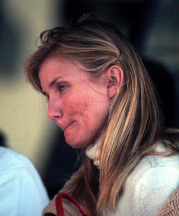 cameron-diaz-est-victime-de-stress-ce-qui (1)
