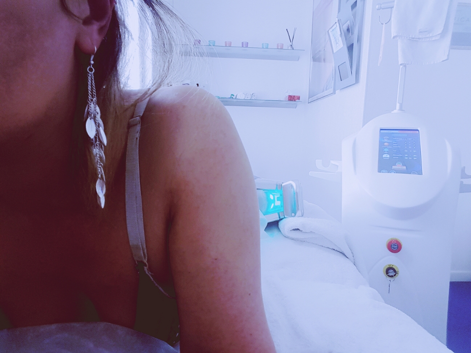 cryolipolise